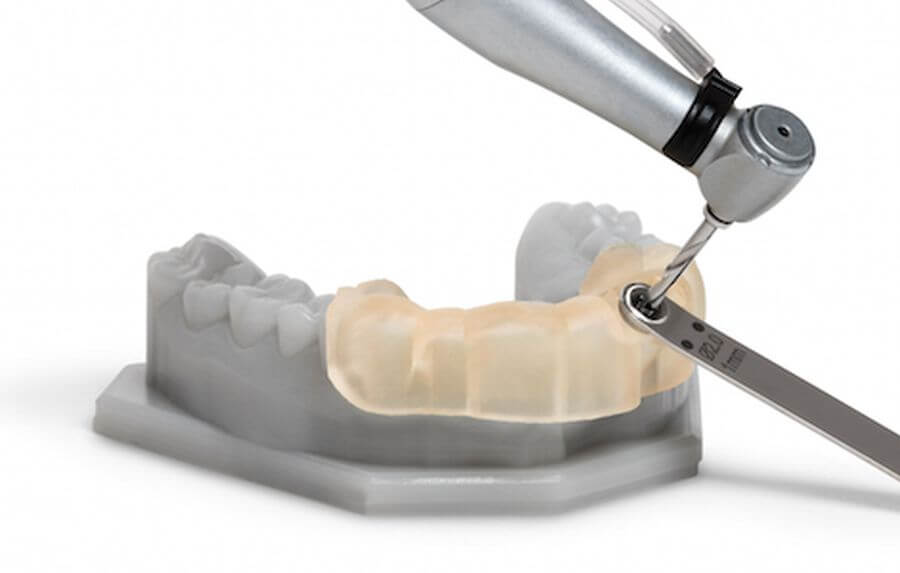 implanturi dentare cu ghid chirurgical timisoara