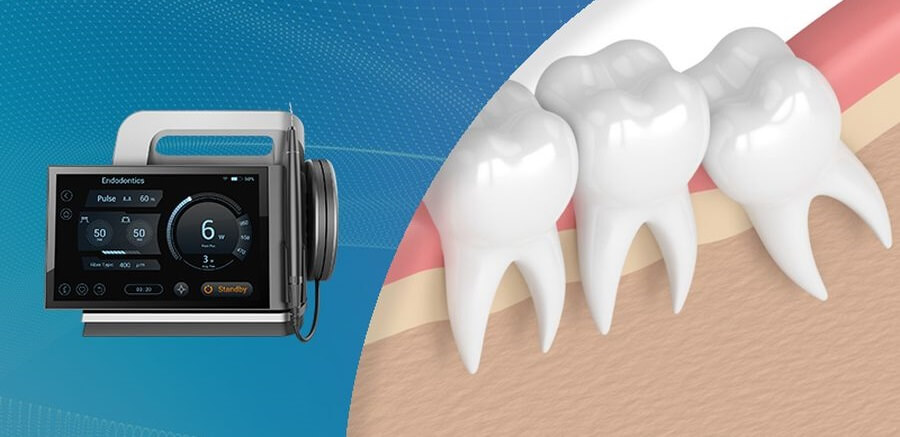 laser dentar Timisoara, laser stomatologie Timisoara