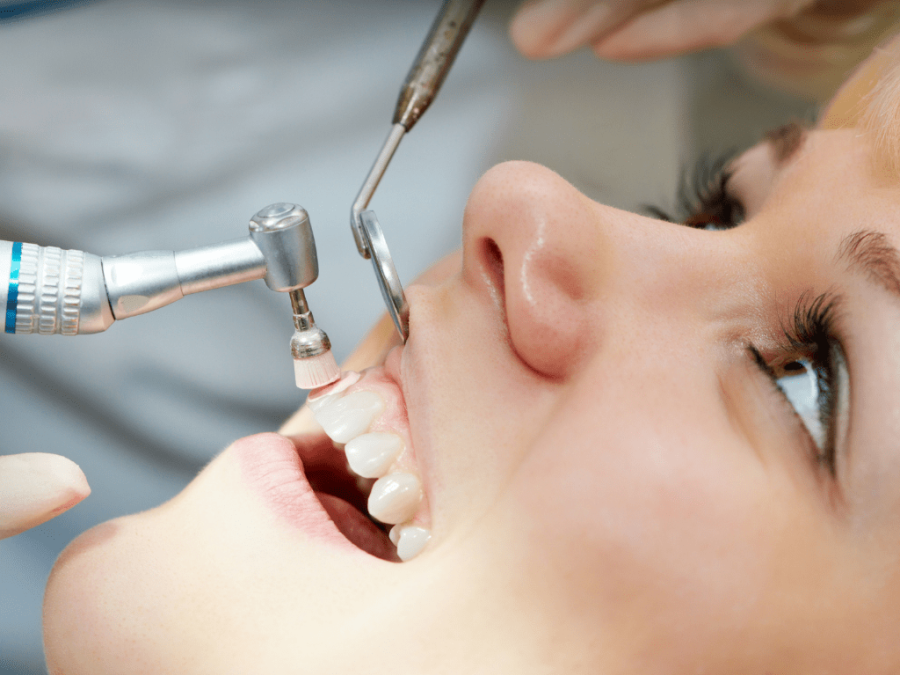 profilaxie dentara Timisoara, clinica dentara stomatologie Timisoara