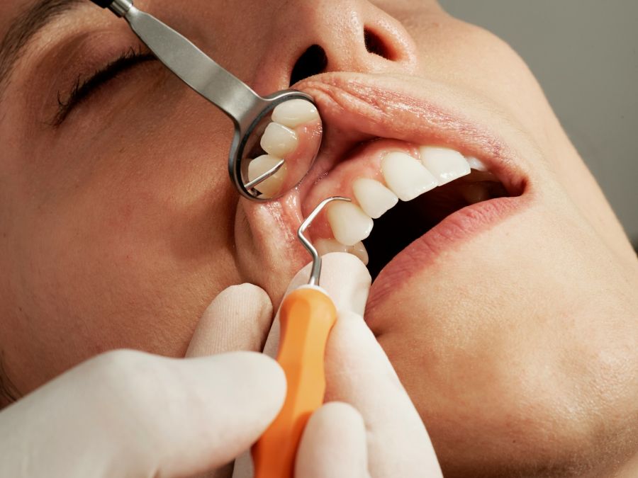 durere gingivala tratament gingivita Timisoara