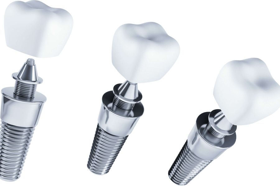 Tratament implant dentar Timișoara