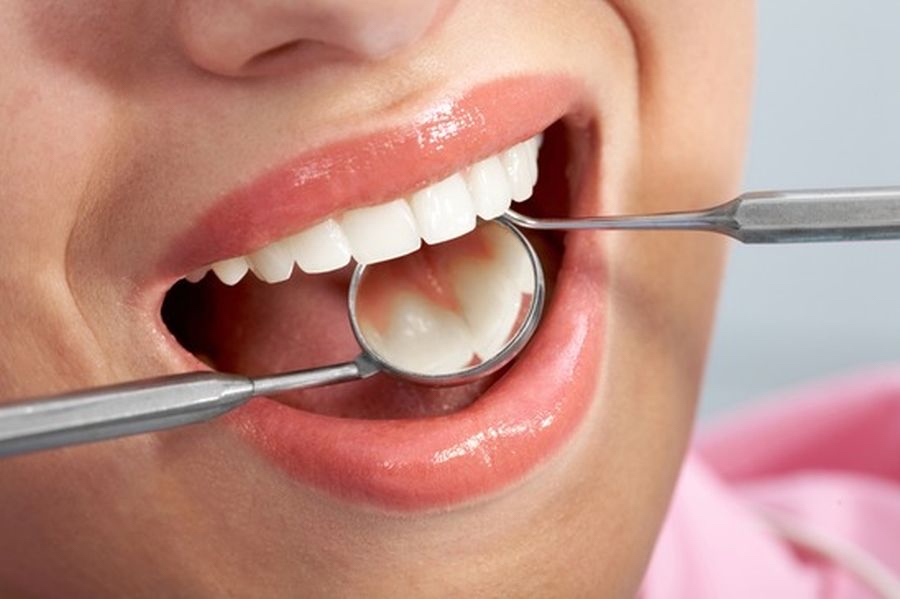 Etapele tratamentului cu fațete dentare