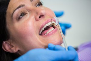 Tipuri de coroane dentare estetica dentara in Timisoara