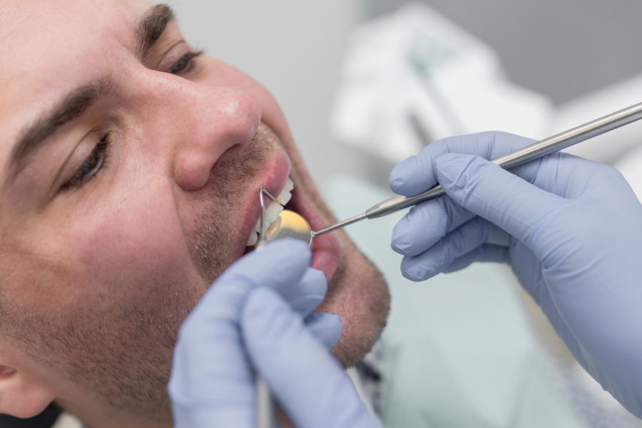 Ce trebuie să știi despre extracție dentară