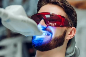 despre albirea dentară laser Timisoara