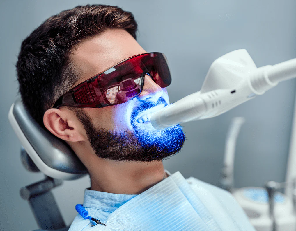 despre albirea dentară laser Timisoara