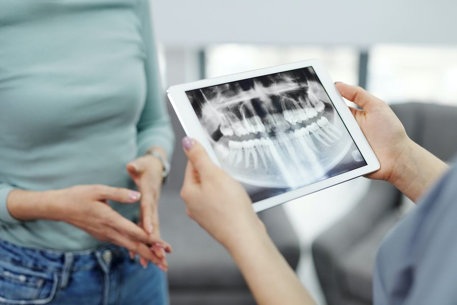 Cât durează un tratament endodontic in Timisoara