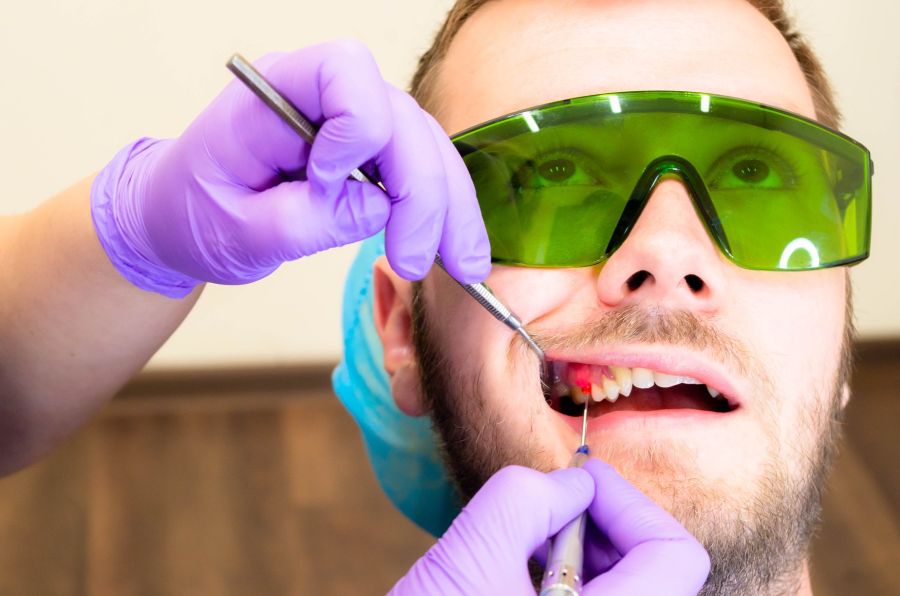 Depigmentarea gingivală cu laser Timisoara