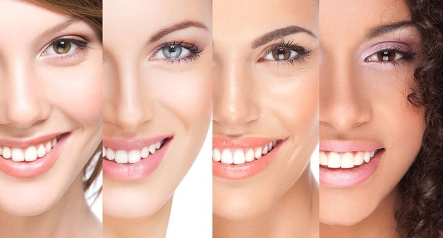 Depigmentarea gingivală cu laser Timisoara
