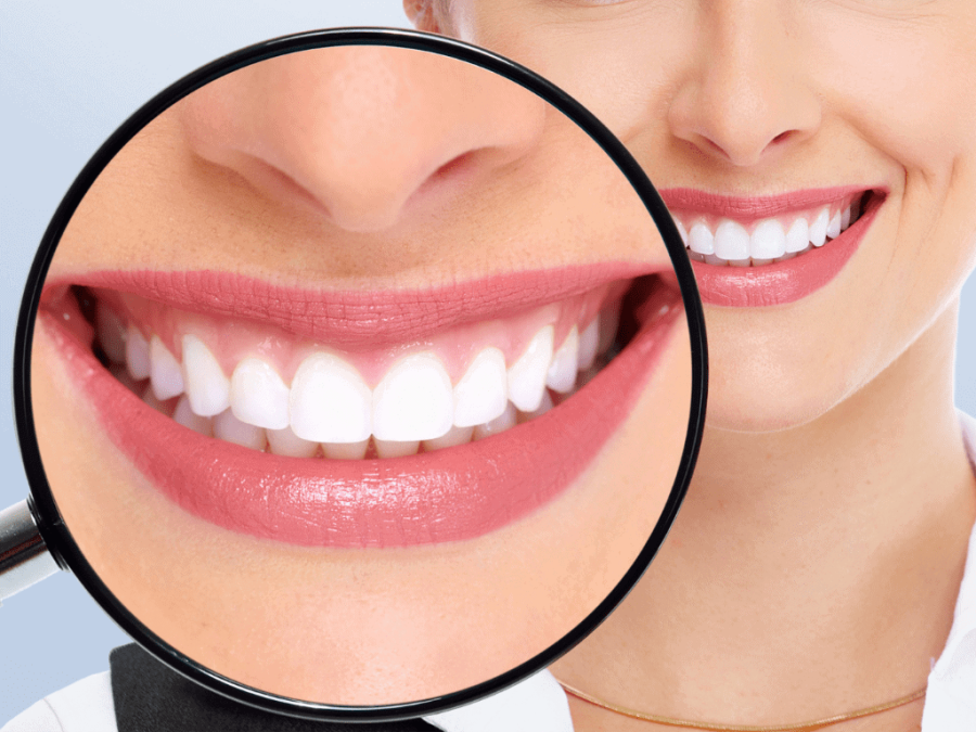 Depigmentarea gingivală cu laser Timisoara