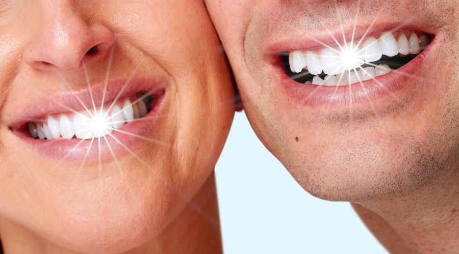 Albirea dentară cu laser in Timisoara
