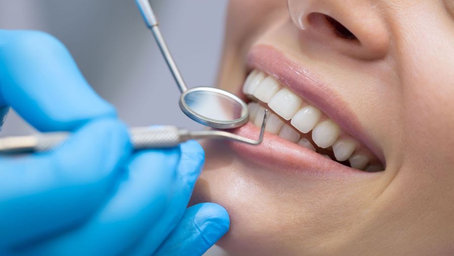 Albirea dentară cu laser in Timisoara