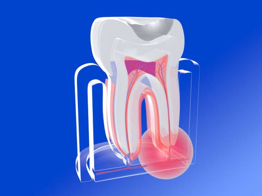 Abces dentar: Cauze și tratament Timisoara