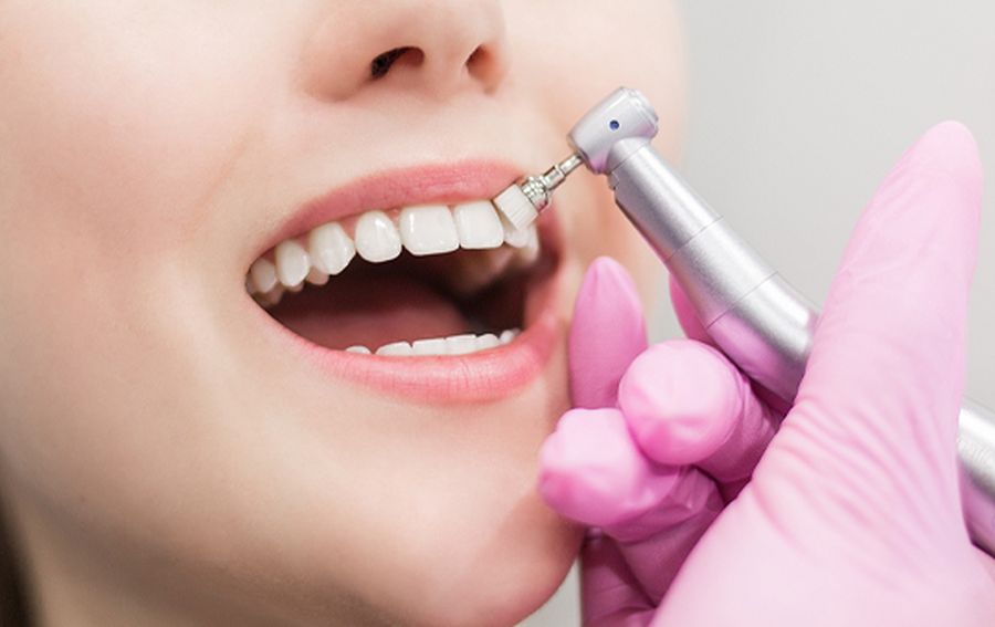 Tratamente de profilaxie dentară Timișoara