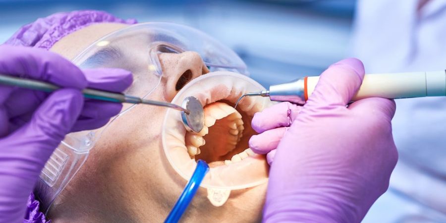 Tratamente de profilaxie dentară Timișoara