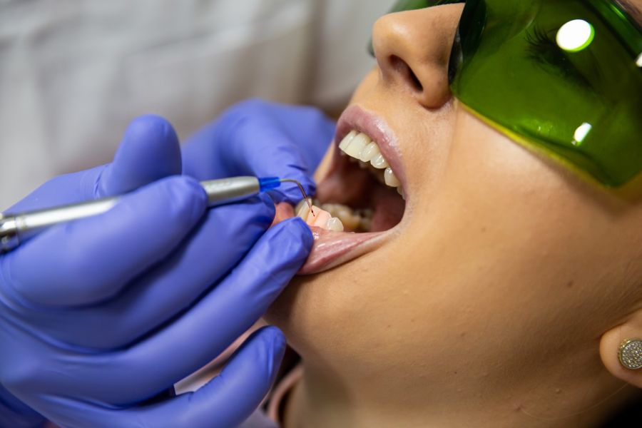 Decontaminare parodontală laser Timișoara