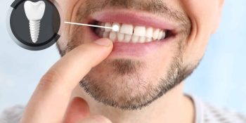 Implanturi dentare și reabilitări totale în Timișoara – soluții moderne pentru un zâmbet funcțional și natural