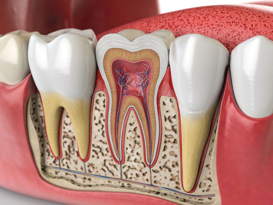 Tratamentul endodontic poate fi soluția